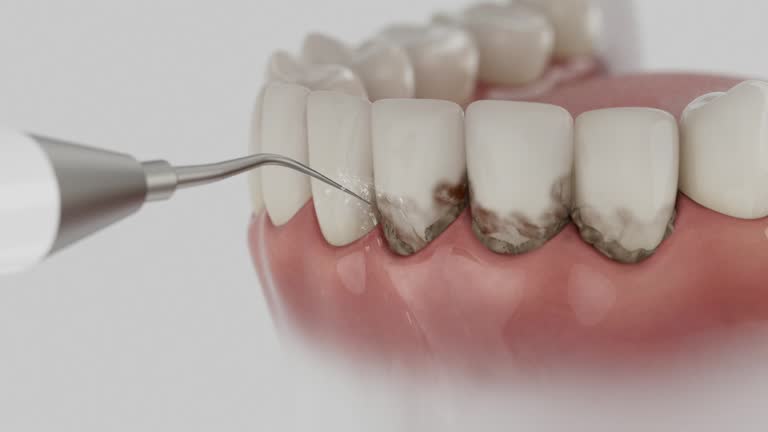 Trusted Dental Crowns And Bridges service in Minneapolis, KS - Dentist Open Now